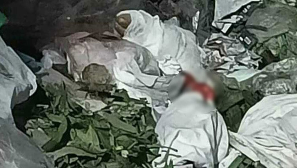 মোহাম্মদপুরে ডাস্টবিনে মিলল মানুষের খণ্ডিত পা